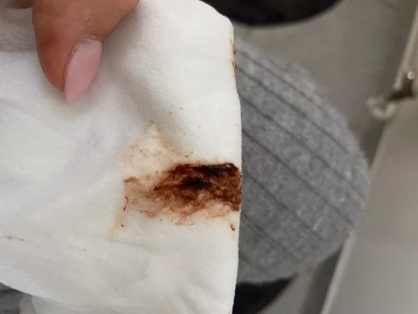 Was verursacht braunen Ausfluss?