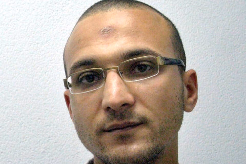 Welche Krebsarten gibt es auf der Kopfhaut?