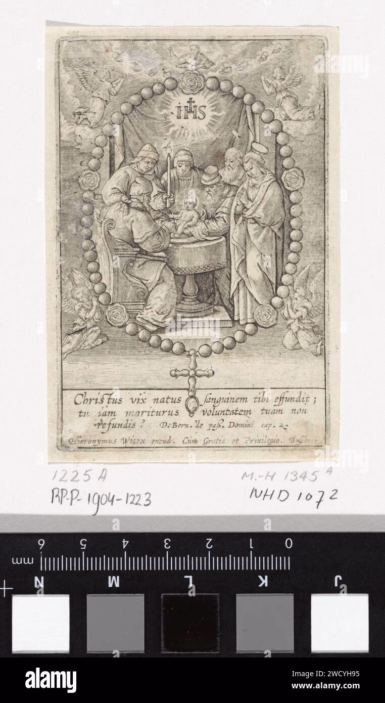 Wann wird die Beschneidung eines Jungen vorgenommen?